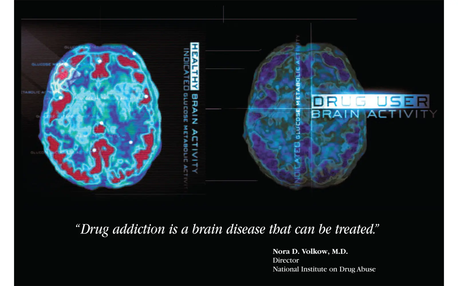 Drug-dependent persons are not recognized as ill
